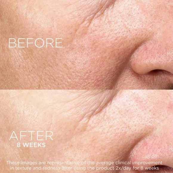 $8❤️🔥 DARPHIN Paris Intral Inner Youth Rescue Serum 🪞 NEW IN BOX - Picture 7 of 10